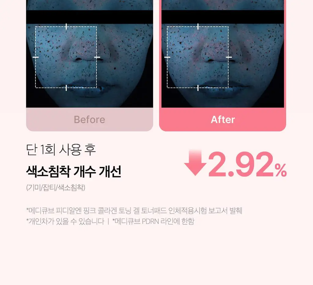 [쿨링광채]메디큐브 PDRN 핑크 콜라겐 토닝 겔 토너패드 70매 기획(본품70매+겔패드10매) 상세페이지 48